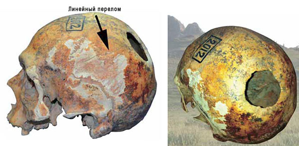 Череп мужчины из кургана 3 курганной группы Кызыл-Джар V («Наука из первых рук» №5/6(65/66), 2015)