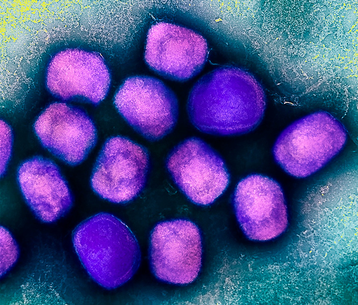 ирус обезьяньей оспы. Поксвирусы — угловатые. Изображение: NIAID | flickr.com («Химия и жизнь» №6, 2022)