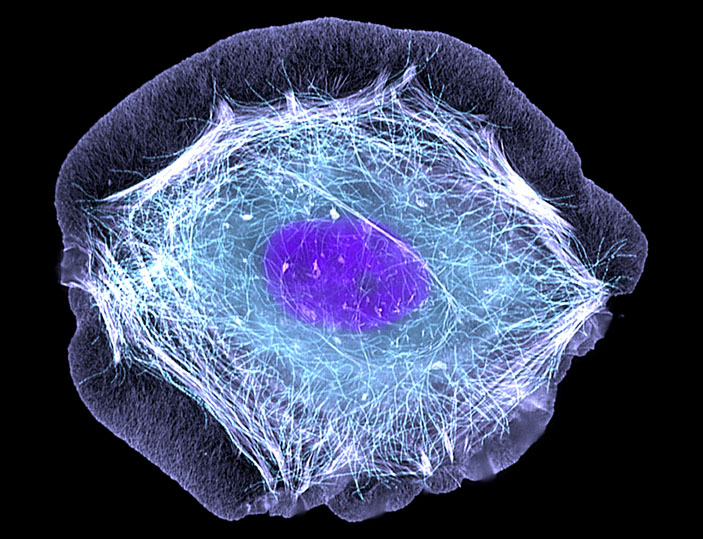 Кератиноцит. Фото: ZEISS Microscopy / Torsten Wittmann, <i>University of California</i>, San Francisco («Наука и жизнь» №1, 2018)