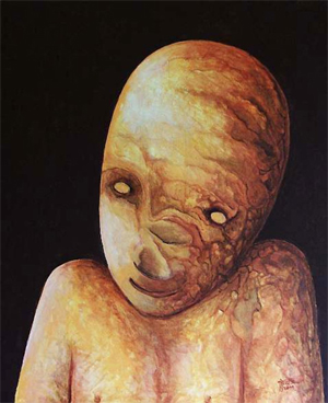  «Проказа». Картина Анджея Троца