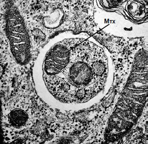 Аутофагия в фибробластах мыши, выращенных на бедной среде. Изображение: Nature Cell Biology, 2010, 12, 823–830 («Химия и жизнь» №11, 2016)