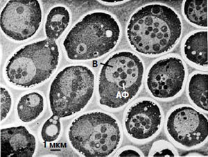Дрожжевые клетки с дефектными ферментами, выращенные на голодной диете. Изображение: Journal of Cell Biology, 1992, 119, 2, 301–311 («Химия и жизнь» №11, 2016) 