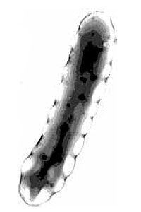 Клетка <i>Ralstonia / Wautersia eutropha</i> B 5786 с «программой синтеза» ПГА. Гранулы по периметру клетки содержат ценный полимер
