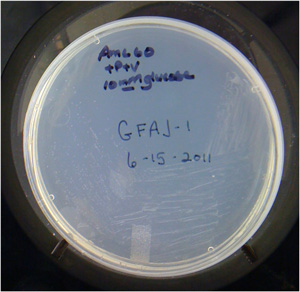 Чашка Петри с колониями «мышьяковой бактерии» GFAJ-1. Фото с сайта rrresearch.fieldofscience.com
