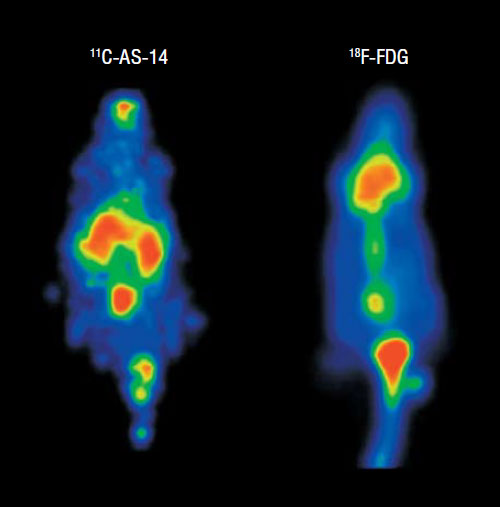 Использование радиофармпрепарата на основе аптамера AS-14, для визуализации опухолей