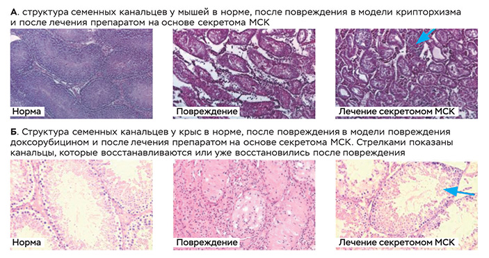 Результаты гистологического исследования у животных с моделируемыми нарушениями сперматогенеза