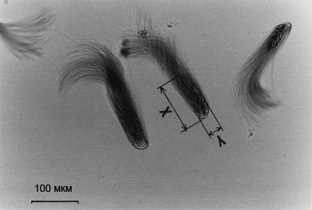 Пучки сперматозоидов 