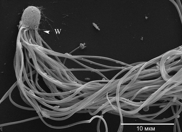 <b>Рис. 3.</b> Сперматозоиды муравьев-бегунков <i>Cataglyphis savignyi</i>. Электронная микрофотография [Pearcy et al., 2014]