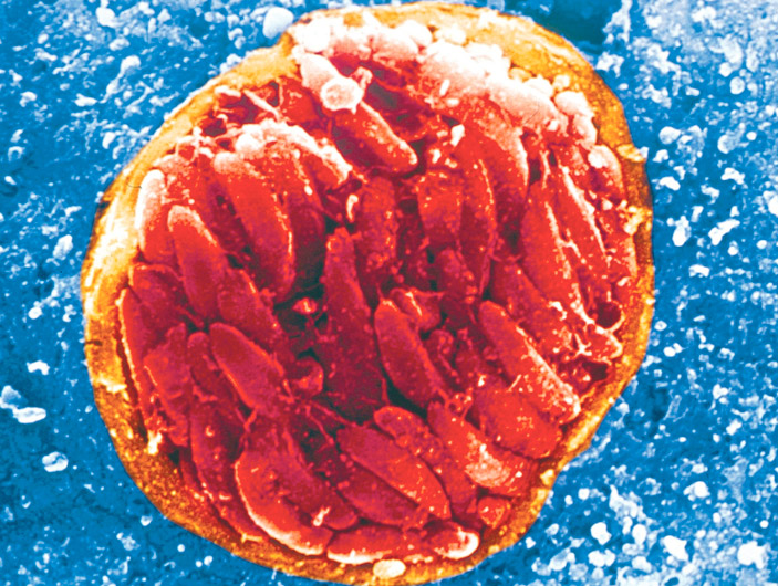 Циста <i>Toxoplasma gondii </i>в мозге. Фото с сайта sciencelife.uchospitals.edu («ТрВ» №11(230), 06.06.2017)
