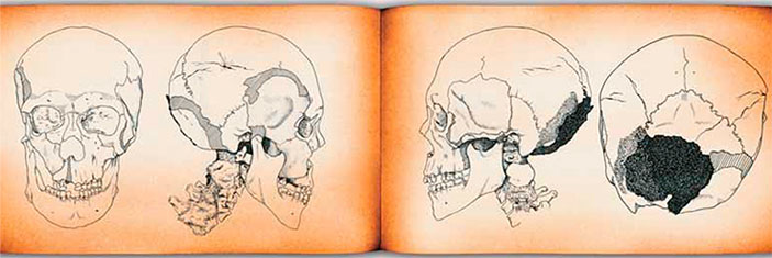Рисунки черепа мумии из могильника Ак-Алаха-3 («Наука из первых рук» №3/4(57/58), 2014)