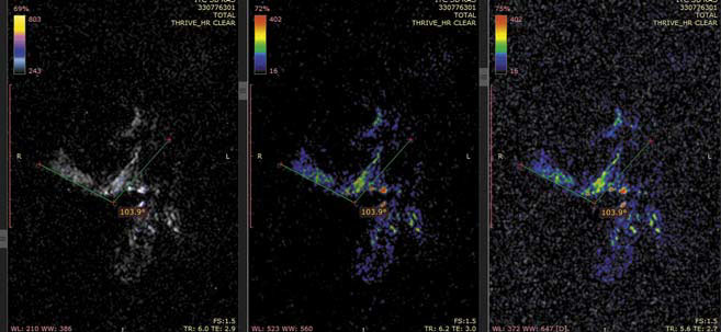 МР-томограмма мумии «Алтайской принцессы», нижняя челюсть («Наука из первых рук» №3/4(57/58), 2014)