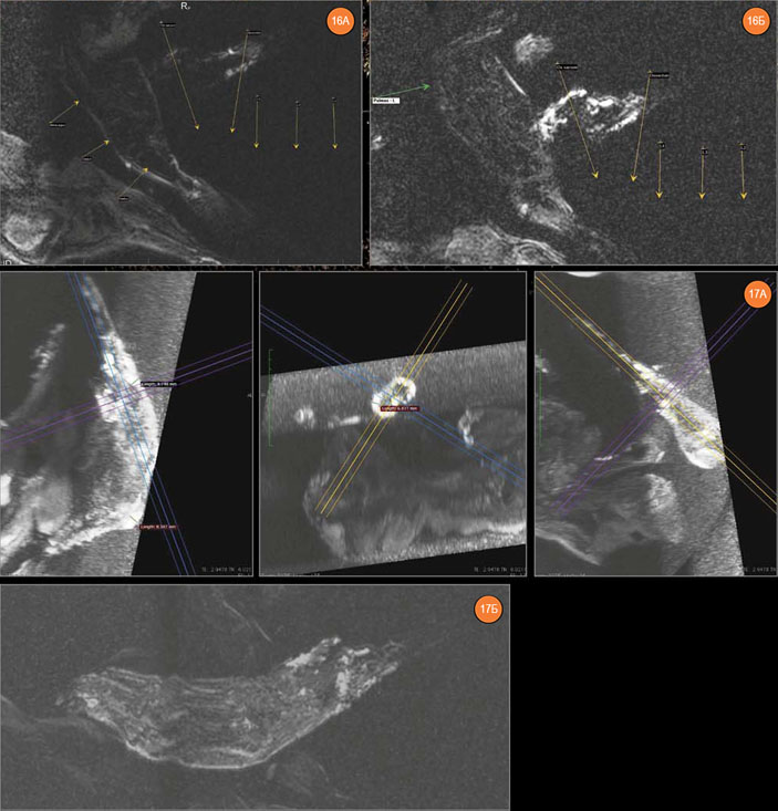 МР-томограммы мумии «Алтайской принцессы» («Наука из первых рук» №3/4(57/58), 2014)