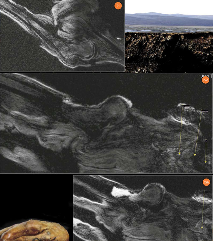 МР-томограммы мумии «Алтайской принцессы» («Наука из первых рук» №3/4(57/58), 2014)