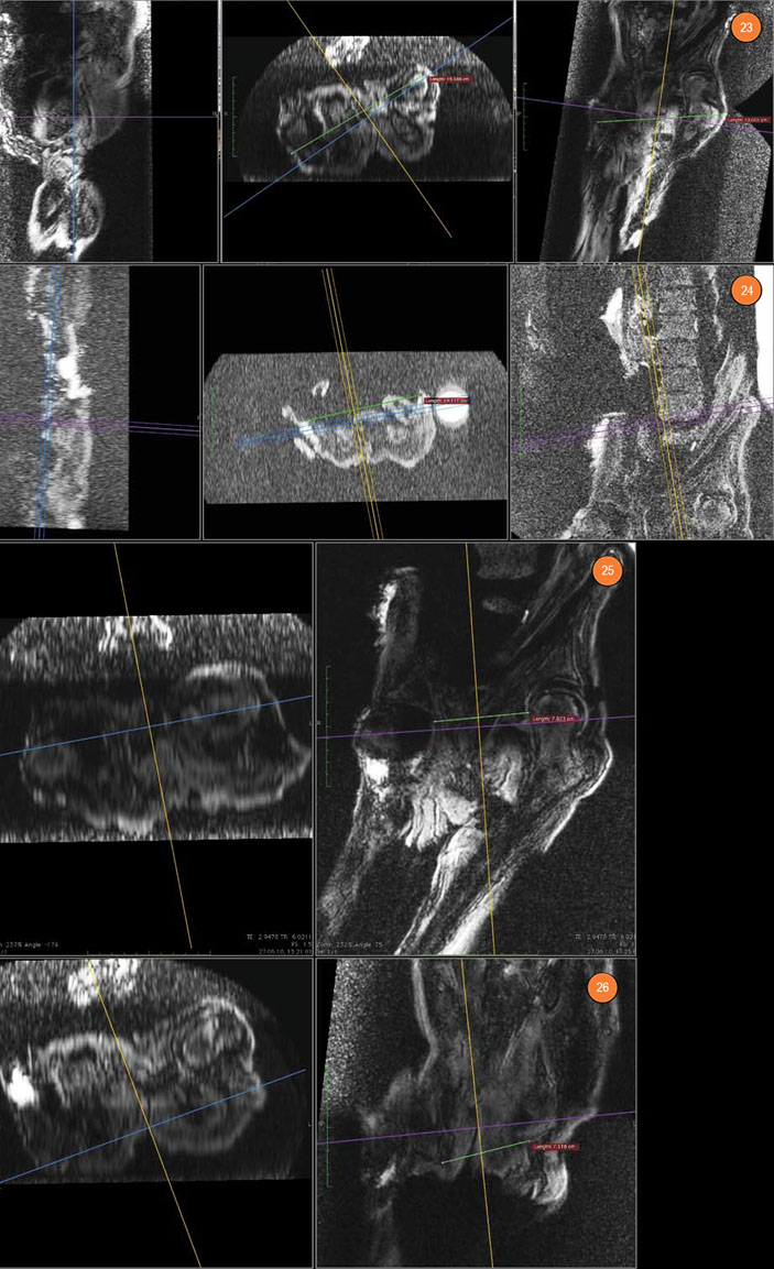 МР-томограммы мумии «Алтайской принцессы» («Наука из первых рук» №3/4(57/58), 2014)
