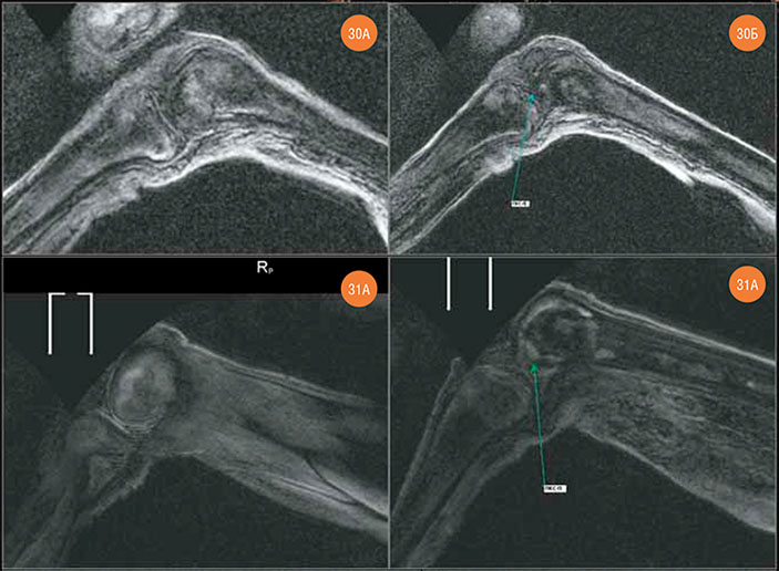 МР-томограммы мумии «Алтайской принцессы» («Наука из первых рук» №3/4(57/58), 2014)