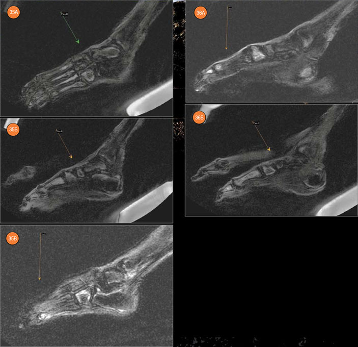 МР-томограммы мумии «Алтайской принцессы» («Наука из первых рук» №3/4(57/58), 2014)