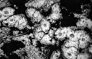 Рис. 6. Комковатая текстура стабильного маггемита  с реликтовым лимонитом диаметром 1 мкм («Природа» №2, 2021) 