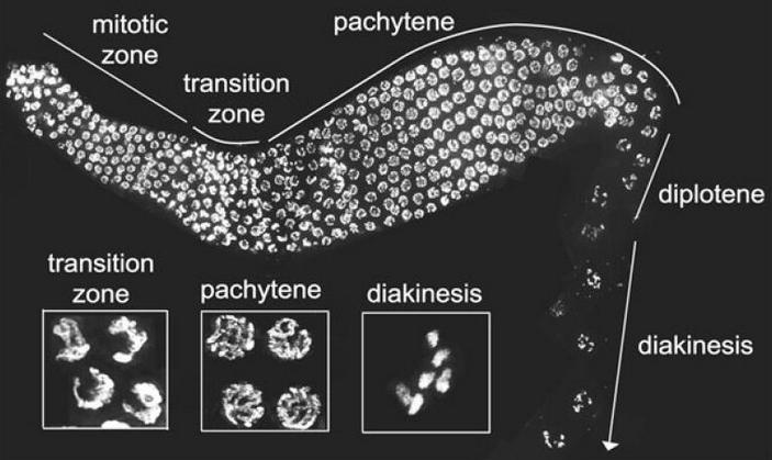 Caenorhabditis elegans