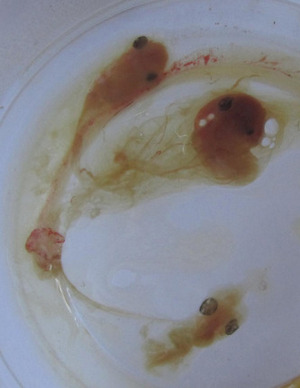 Три эмбриона в яйце