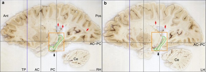 Гиппокамп Г.М.