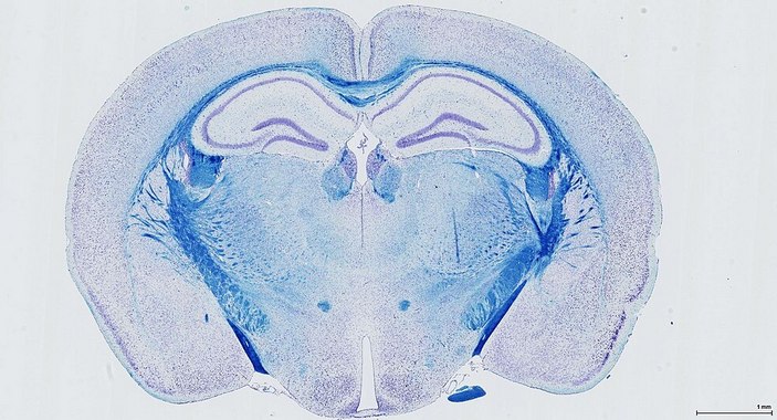 Срез мозга мыши