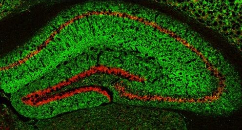 Окрашенный гиппокамп