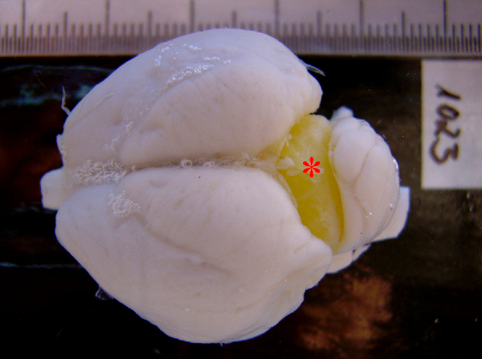 Жировое тело в мозгу утки