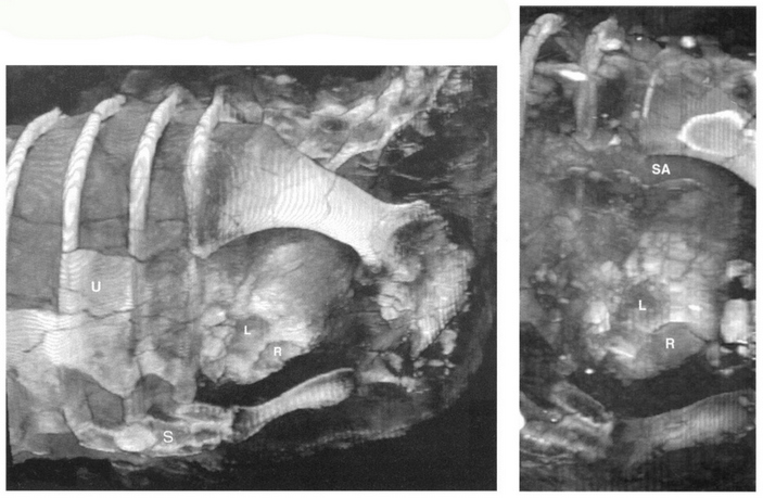 Томографические снимки