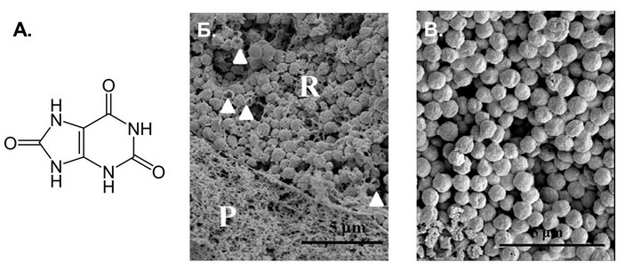 Лантерн под микроскопом