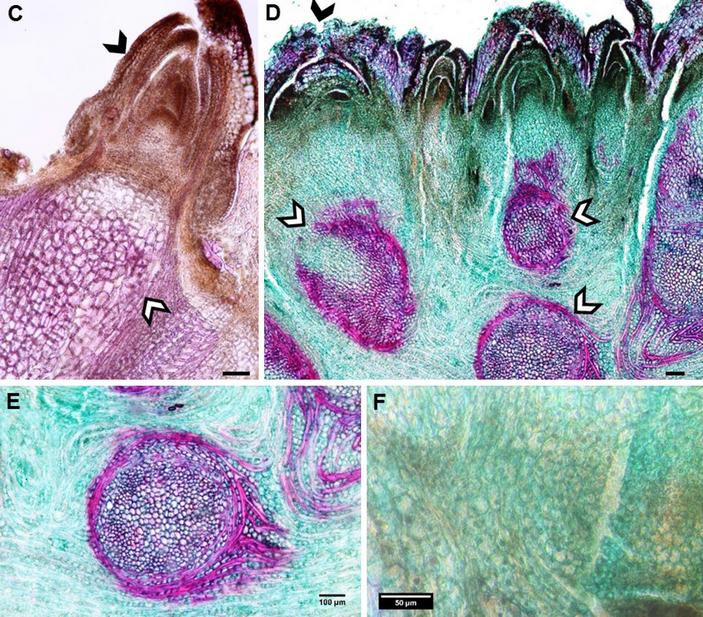 Анатомия лигнотубера
