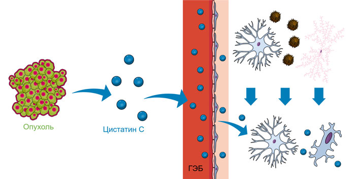 Рис. 3. Опухолевые клетки разных типов секретируют цистатин C, который выделяется в кровь, проникает через гематоэнцефалический барьер и способствует разрушению амилоидных бляшек