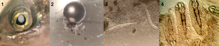 Глаз рыбы, зараженной трематодами