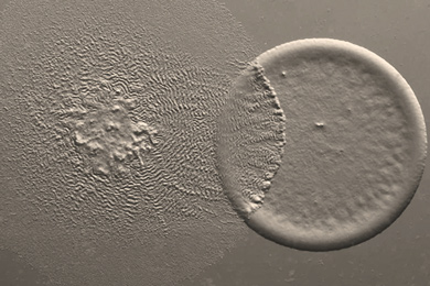 Бактерии Myxococcus xanthus нападают на колонию кишечных палочек