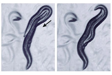 Нервная система C. elegans. Нейроны помечены зеленым флуоресцирующим белком