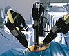 Робот da Vinci Surgical System в действии (фото с сайта robosapiens.mit.edu)