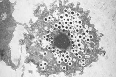 Клетка амебы, заполненная частицами гигантского вируса