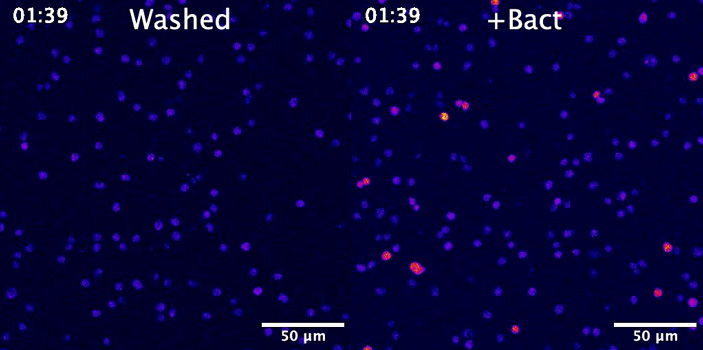 Рис. 3. При добавлении бактерий кальциевые токи в клетках хоанофлагелляты возникают чаще
