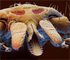 Голова иксодового клеща (фото с сайта www.eyeofscience.de)