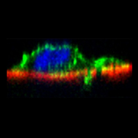 Фосфорилирование под действием LIM-киназы (LIMK) приводит к инактивации кофилина. Рисунок из статьи R. Scott & M. Olson (2007) в Journal of Molecular Medicine