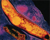 Mycobacterium tuberculosis (изображение с сайта biology.kenyon.edu)