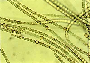 Цианобактерия Anabaena variabilis, несмотря на аэробное существование, способна фиксировать азот. Азотфиксация происходит у этой бактерии в гетероцистах (крупных клетках с утолщенными стенками), предотвращающих доступ кислорода в клетку. У этой бактерии азотфиксация катализируется ванадийсодержащими ферментами, а не молибденсодержащими, как у большинства других микроорганизмов. Фото с сайта dictall.com