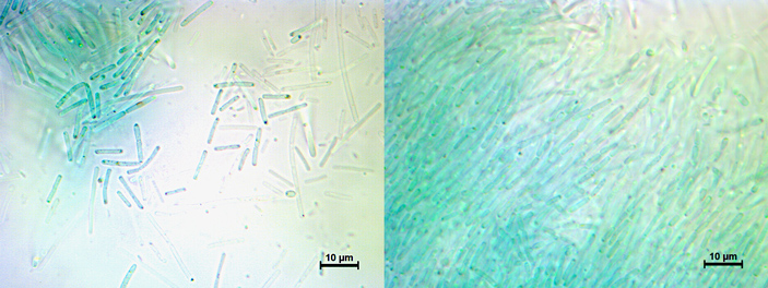 Рис. 8. Новооткрытый вид Anthocerotibacter panamensis