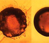 Обычный вид бактерии Pseudomonas aeruginosa (слева) и она же после тридцатипятилетней эволюции в условиях больницы (справа). Фото с сайта www.pnas.org