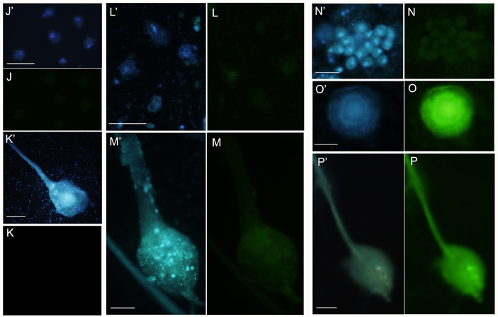 Рис. 6. Dictyostellium discoideum на одноклеточных и многоклеточных стадиях жизненного цикла
