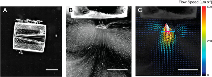 Рис. 1. Диатомовая водоросль Coscinodiscus wailesii и ее эпибионты — инфузории Pseudovorticella coscinodisci