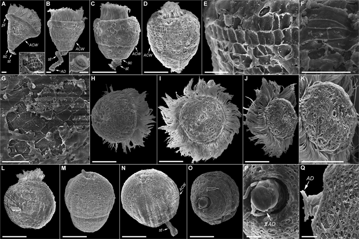 Рис. 2. Внешний вид кругоресничных инфузорий Pseudovorticella coscinodisci под электронным микроскопом