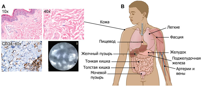Губчатая структура в соединительной ткани человека