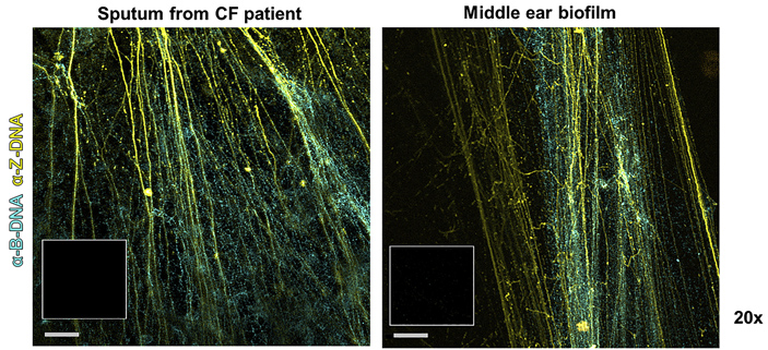 Рис. 2. Правозакрученная ДНК и левозакрученная ДНК в биопленках
