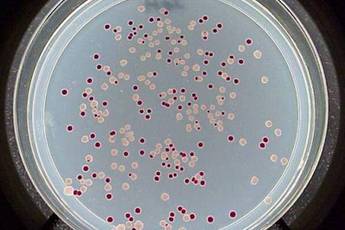 Колонии Escherichia coli в чашке Петрина среде из агара, содержащего арабинозу