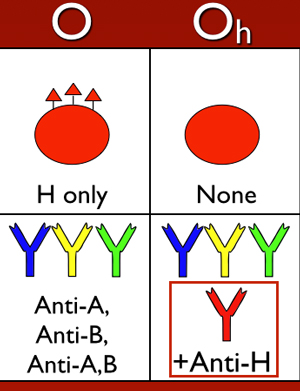 Рис. 4. При «бомбейском фенотипе» в плазме крови присутствуют антитела анти-H, в основном представленные иммуноглобулинами M и способные вызвать острую гемолитическую реакцию